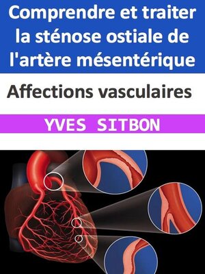 cover image of Affections vasculaires